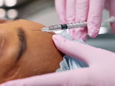 Anti-Wrinkle Injections Hyderabad