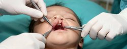 Cleft Lip Surgery in Hyderabad Logo