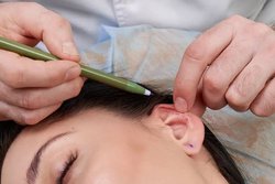 Ear correction surgery Hyderabad Logo