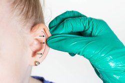 Ear correction surgery in Hyderabad Logo