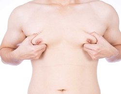 massive gynaecomastia correction in Hyderabad Logo