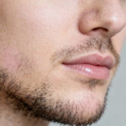 Moustache hair transplant in Hyderabad Logo