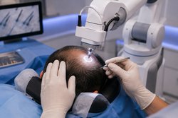 Robotic hair transplant Hyderabad Logo