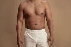 Skin Excision Gynecomastia Surgery in Hyderabad Logo