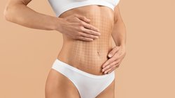 Tummy Tuck Surgery in Hyderabad Logo